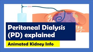 Peritoneal Dialysis explained [upl. by Nora736]