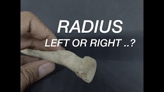 RADIUS  SIDE DETERMINATION [upl. by Hibbitts]