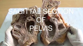 SAGITTAL SECTION OF PELVIS  DEMONSTRATION  ANATOMY [upl. by O'Gowan]