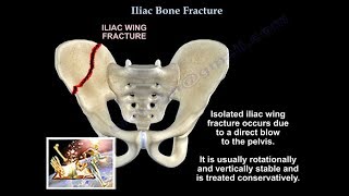 SelfCorrection Technique for SI Joint Pain Anterior Rotation [upl. by Halle]