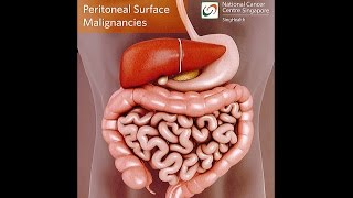 Anatomy of the small intestine  dissection [upl. by Airak441]