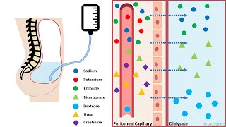 Peritoneal Dialysis [upl. by Neelra854]