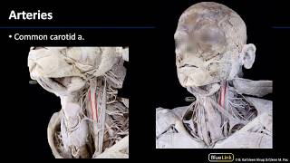 Anterior Neck  Arteries [upl. by Wallford]