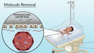 Peritoneal Recesses Dr Adel Bondok Making Anatomy Easy [upl. by Adarbil]