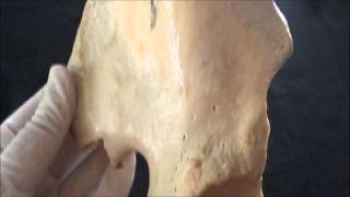 Hip bone anatomy  Part 2  The Ilium [upl. by Naihr]